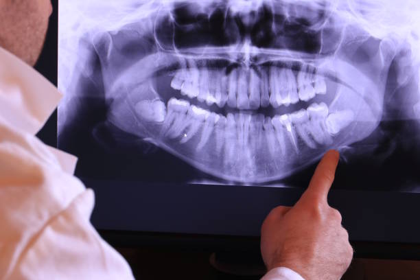 Best Emergency Dental Care for Broken or Chipped Teeth in Higginsville, MO