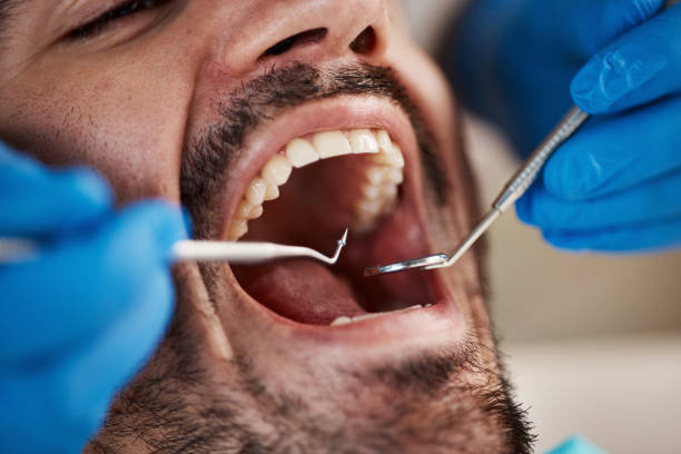 Best Cosmetic Emergency Dentistry in Higginsville, MO