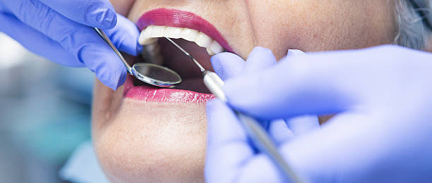 Best Emergency Tooth Extraction in Higginsville, MO